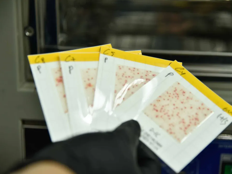 Placas de recuento microbiológico